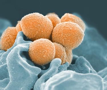 Postbiotics in Skincare: Microbiome Healing