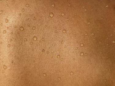 Pterostilbene Skincare Shows Promise in Wrinkle Reduction
