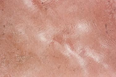 Kojic Acid Rivals Hydroquinone as Natural Brightening Agent