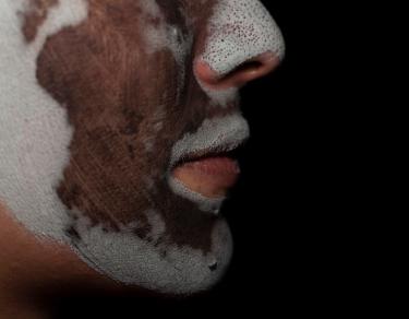 How AI Skin Analysis Tools Personalize Your Routine