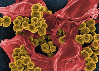 Hypochlorous Acid: Dermatology's Gentle Antimicrobial Revolution